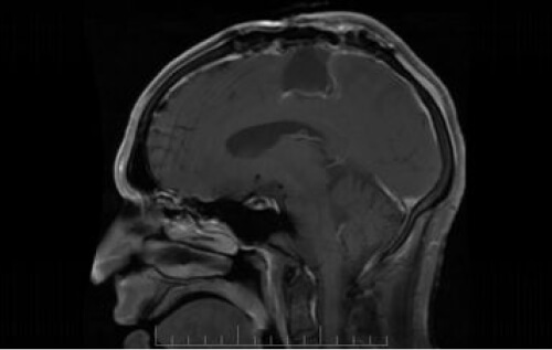 Head MRI Scans